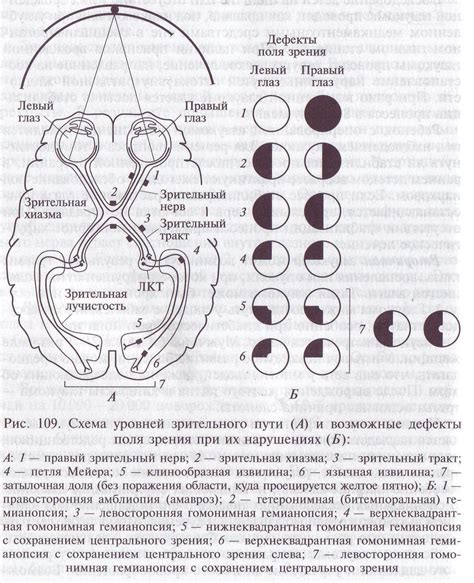 Влияние особенностей зрительной системы на спортивную карьеру