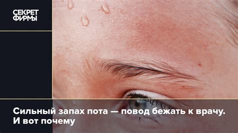 Возраст появления запаха пота у мальчиков