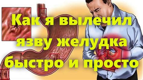 Какой псалом выбрать при болезни желудка