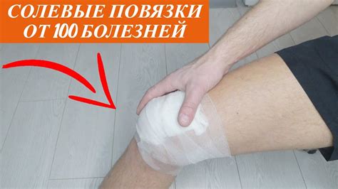 Как зафиксировать лопух на коленке