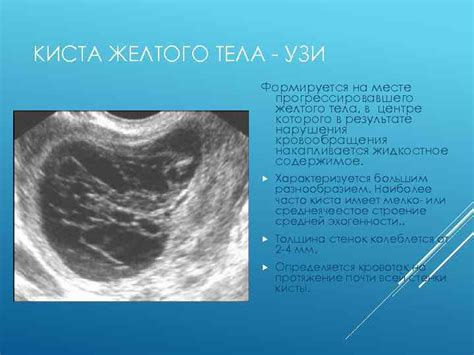 Норма размера желтого тела