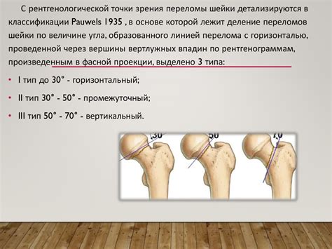Ожидаемые сроки восстановления в зависимости от типа перелома