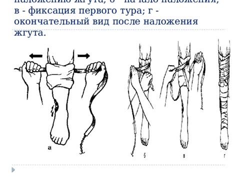 Подготовка к наложению знака квен