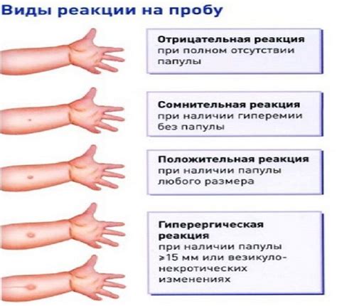 Реакция на приказ: положительная и отрицательная