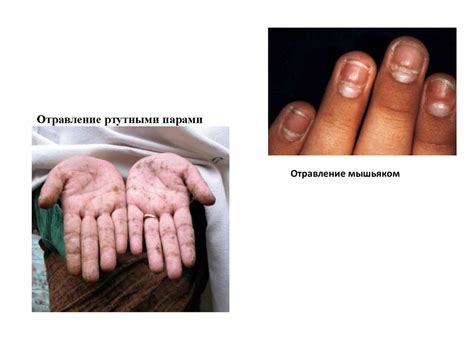 Смерть хомяка-курильщика от отравления дымом