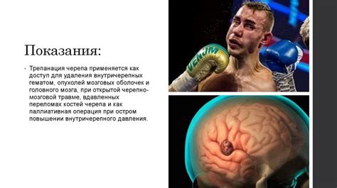 Как правильно мыть голову после трепанации черепа