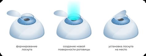 Раздел 1: Влияние лазерной коррекции зрения на наращивание ресниц