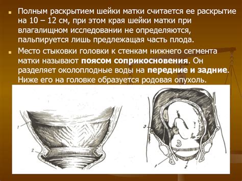 Раскрытие шейки матки при повторных родах