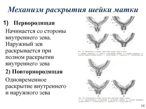 Что ожидать при полном раскрытии шейки матки